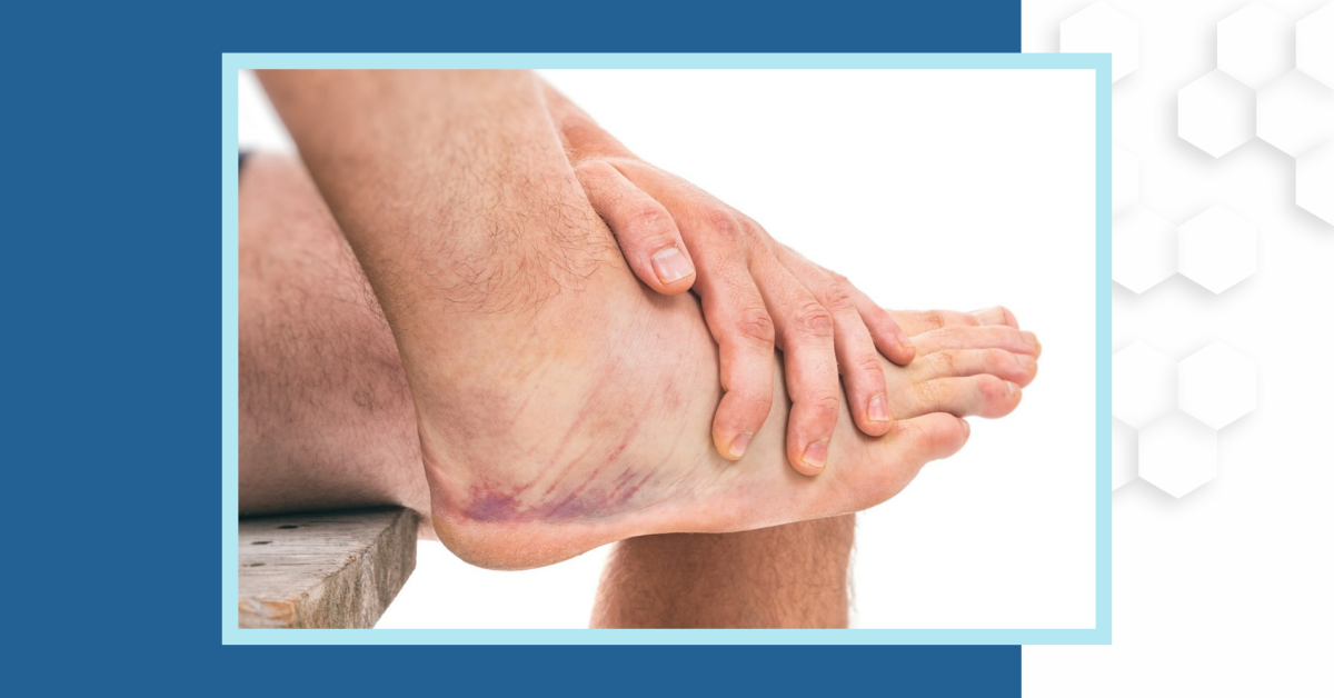 Get the jump on ankle sprains: Ankle sprain diagnosis