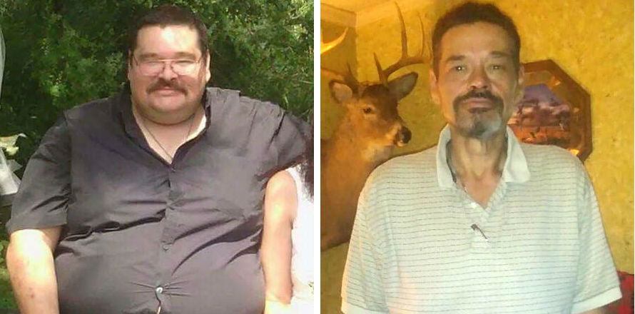 Alan’s story: ‘2nd lease on life’ with weight-loss surgery